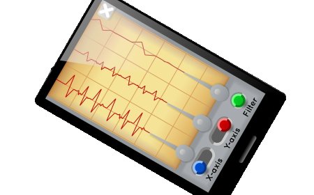 Cardiac Rhythm Interpretation and EKG Analysis