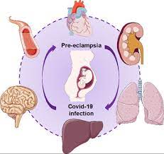 Mild Preeclampsia