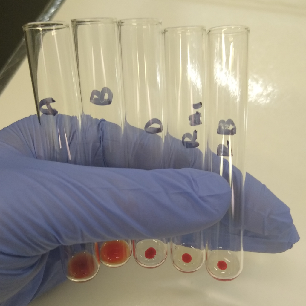 Virtual Lab: Understanding Antibodies and the Compatibility of Blood Types