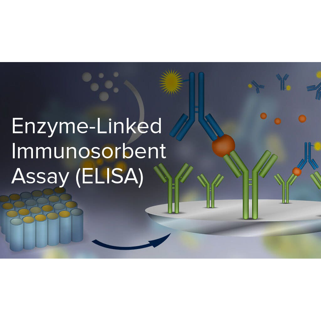 Virtual Lab on ELISA