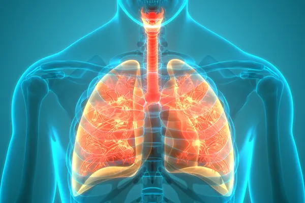 Postoperative Care of the Patient with Complications: Pneumonia