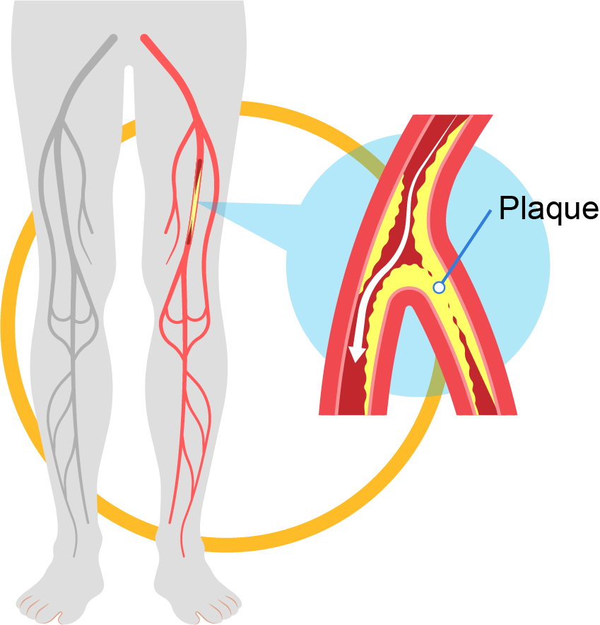 Peripheral Vascular System Assessment