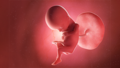 Fetal Tachycardia Due to Maternal Pyrexia