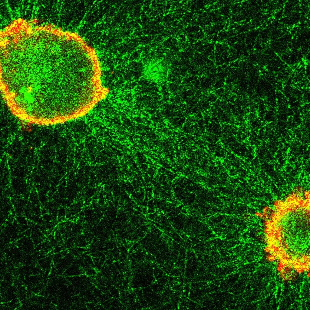 Virtual Lab for Confocal Microscopy