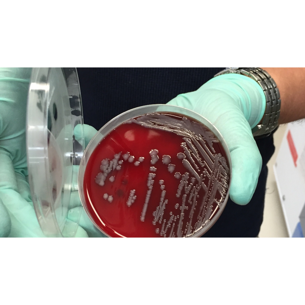 Virtual Lab: Studying Genetic Transfer in Bacteria to Combat Superbug Emergence