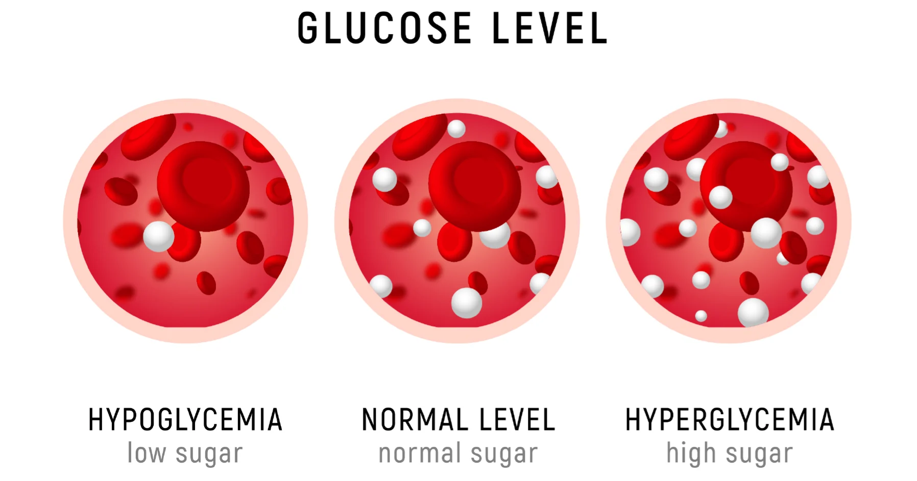 Diabetes: Hypoglycemia