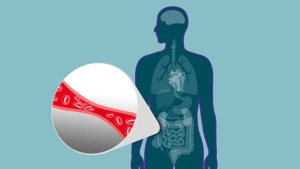 Management of Digoxin Toxicity in a Patient with Heart Failure