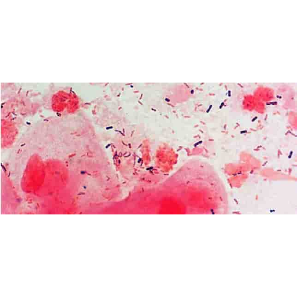 Virtual Lab: Understanding the Mechanisms of Stains and Counterstains in Gram Staining